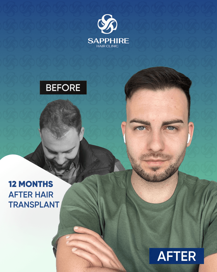 Before After 3